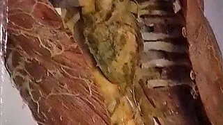 X Nxn