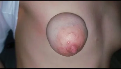 Poren Vedios