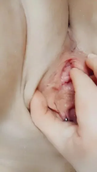 My Fickspalte Needs It!