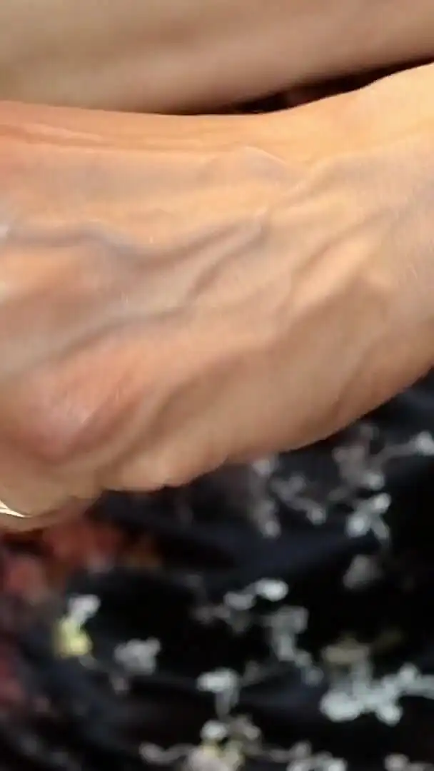 The Large and Numerous Veins in My Hands