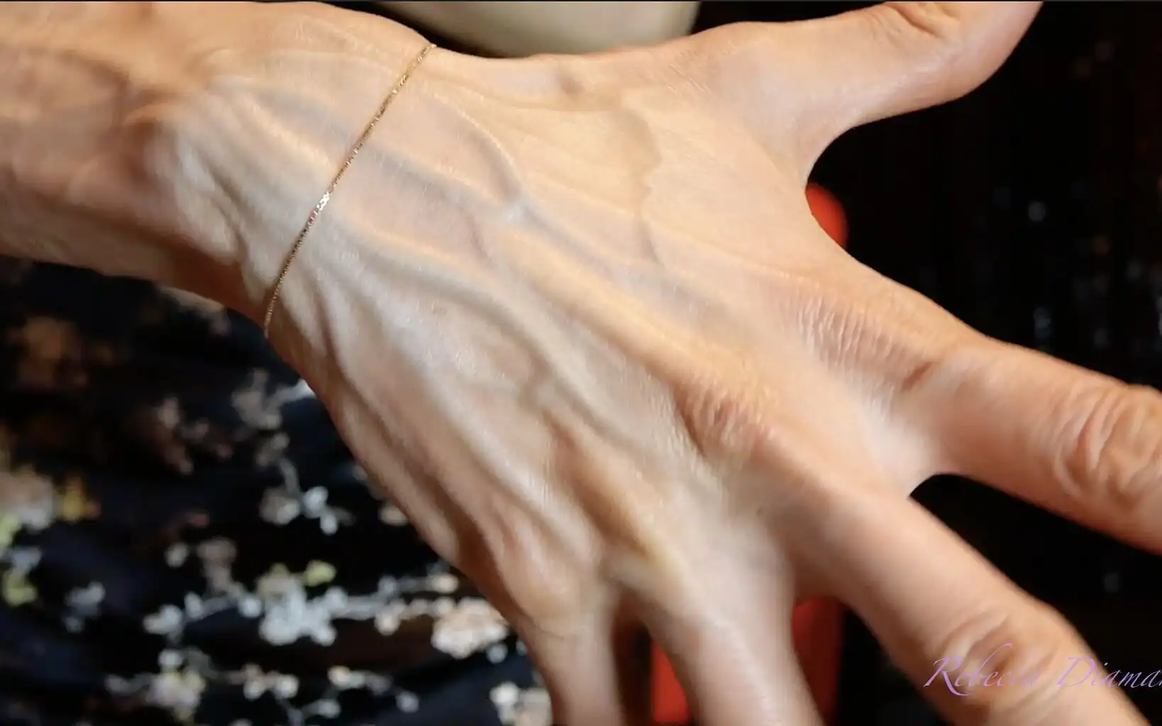The Large and Numerous Veins in My Hands