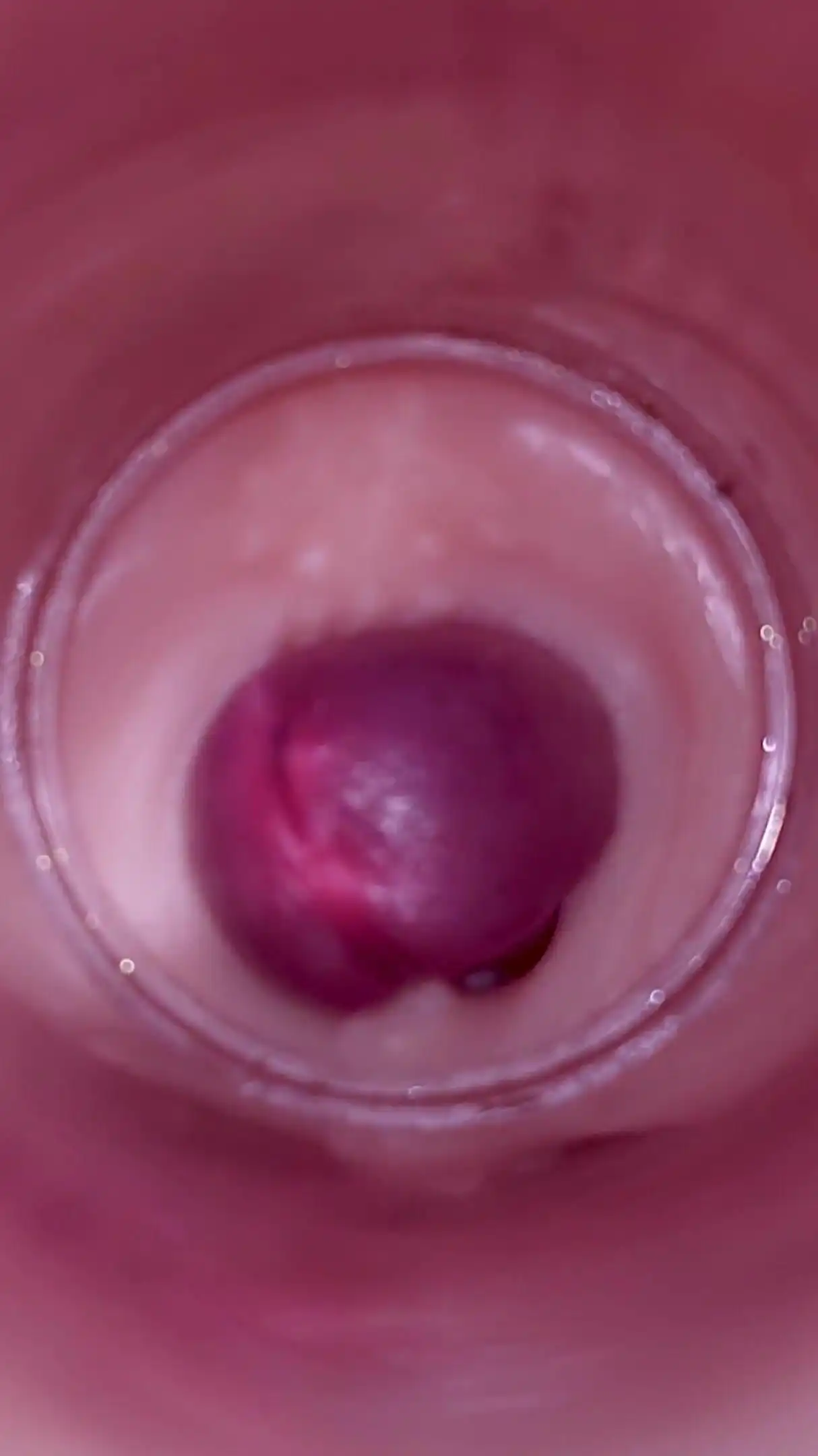 Female Insemination - Internal Camera Captures Deep Male Ejaculation