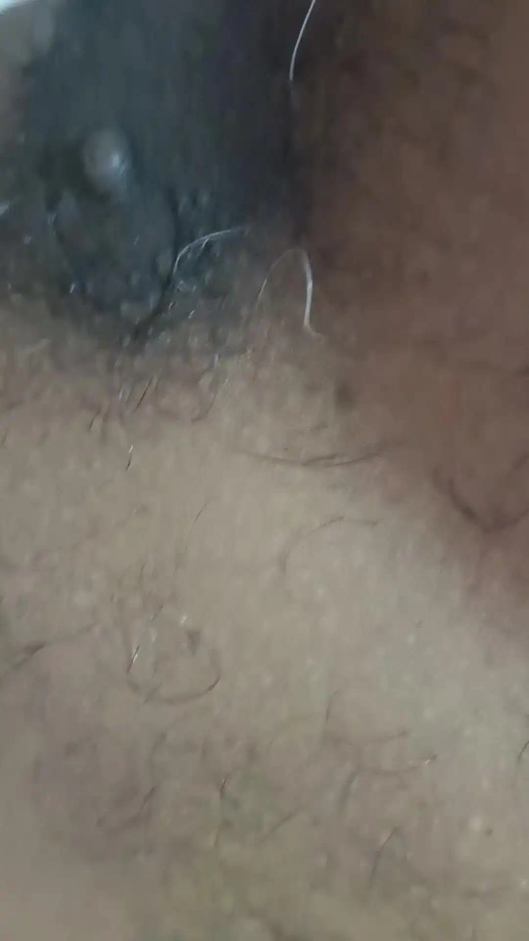 Hairy Ass